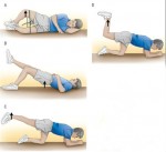 Hip Strengthening