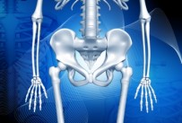 Hip Impingement Syndrome