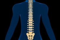 Spinal fusion surgery