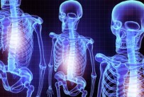 Do you need an X-ray or MRI of your back?