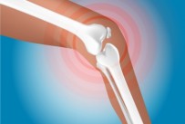 What does physics have to do with knee pain?
